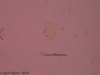 Anthyllis montana - lame n° 34648