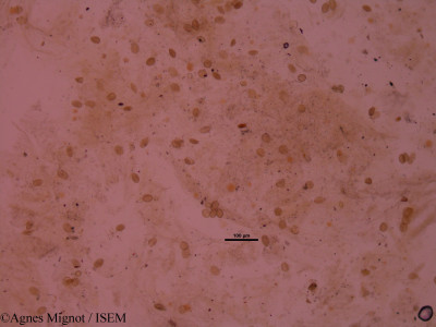 Agnes.Mignot/Biscutella_laevigata_33035/Biscutella_laevigata_33035_0001(copy)_thumb.jpg