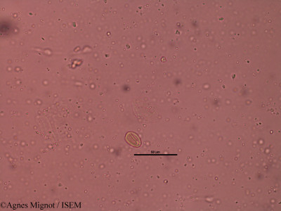 Draba verna - lame n° 32231