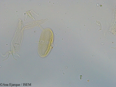 Vicia faba var. minor - lame n° 31141