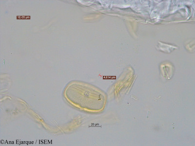 Vicia faba var. minor - lame n° 31141