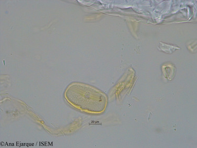 Vicia faba var. minor - lame n° 31141