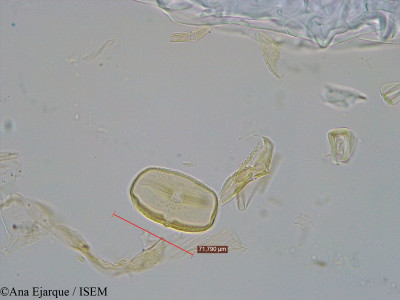 Vicia faba var. minor - lame n° 31141