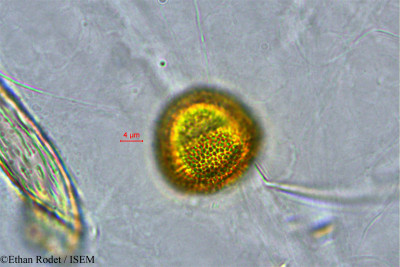 Ethan.Rodet/Cladogelonium_sp_33868/Cladogelonium_sp_33868_0001(copy)_thumb.jpg