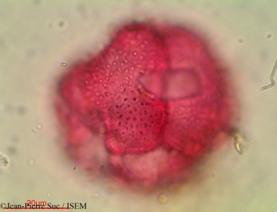 Aldrovanda vesiculosa - lame n° 28773