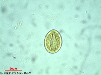 Jean-Pierre.Suc/Avicennia_tonduzii_10885/Avicennia_tonduzii_10885_0001(copy)_thumb.jpg