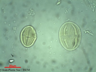 Jean-Pierre.Suc/Odyendyea_gabonensis_14559/Odyendyea_gabonensis_14559_0001(copy)_thumb.jpg