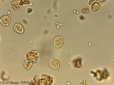 Karl.Henga/Acridocarpus_longifolius_11011/Acridocarpus_longifolius_11011_0001(copy)_thumb.jpg