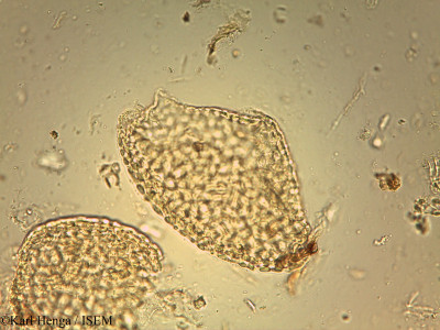 Karl.Henga/Anonidium_mannii_25824/Anonidium_mannii_25824_0001(copy)_thumb.jpg
