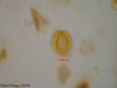Karl.Henga/Anthonotha_crassifolia_14291/Anthonotha_crassifolia_14291_0001(copy)_thumb.jpg