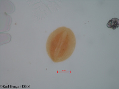 Karl.Henga/Anthonotha_gilletii_9661/Anthonotha_gilletii_9661_0001(copy)_thumb.jpg