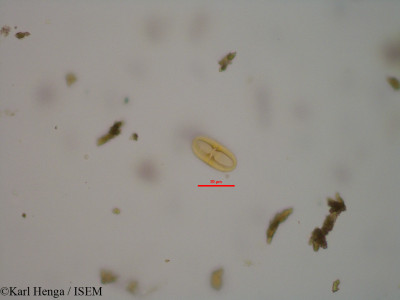 Karl.Henga/Antidesma_oblongatum_33998/Antidesma_oblongatum_33998_0001(copy)_thumb.jpg
