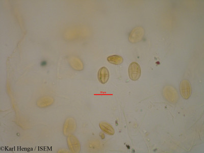 Karl.Henga/Antidesma_venosum_8597/Antidesma_venosum_8597_0001(copy)_thumb.jpg