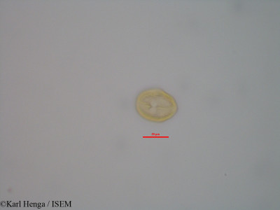 Karl.Henga/Antrocaryon_micraster_40167/Antrocaryon_micraster_40167_0001(copy)_thumb.jpg
