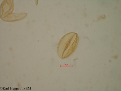 Karl.Henga/Aphanocalyx_margininervatus_35163/Aphanocalyx_margininervatus_35163_0001(copy)_thumb.jpg