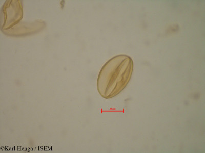 Aphanocalyx margininervatus - lame n° 35163