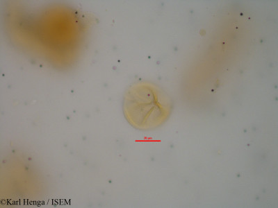 Karl.Henga/Aubrevillea_platycarpa_10431/Aubrevillea_platycarpa_10431_0001(copy)_thumb.jpg