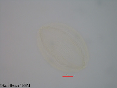 Karl.Henga/Berlinia_acuminata_39774/Berlinia_acuminata_39774_0001(copy)_thumb.jpg