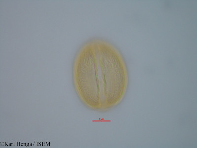 Karl.Henga/Berlinia_congolensis_42355/Berlinia_congolensis_42355_0001(copy)_thumb.jpg