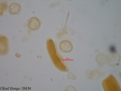 Karl.Henga/Bertiera_bracteolata_1803/Bertiera_bracteolata_1803_0001(copy)_thumb.jpg