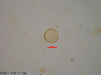 Bertiera capitata - lame n° 1800