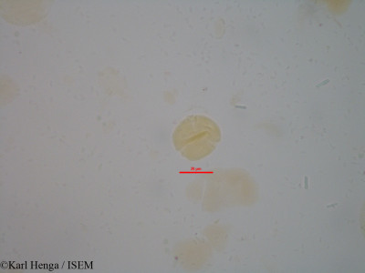 Karl.Henga/Bertiera_subsessilis_1802/Bertiera_subsessilis_1802_0001(copy)_thumb.jpg