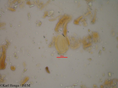Karl.Henga/Biophytum_zenkeri_714/Biophytum_zenkeri_714_0001(copy)_thumb.jpg