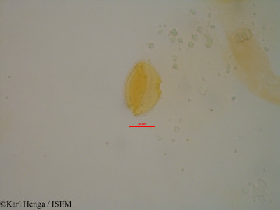 Karl.Henga/Canthium_sylvaticum_18437/Canthium_sylvaticum_18437_0001(copy)_thumb.jpg