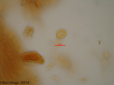 Karl.Henga/Cassipourea_congoensis_13117/Cassipourea_congoensis_13117_0001(copy)_thumb.jpg