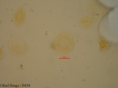 Karl.Henga/Cola_acuminata_23617/Cola_acuminata_23617_0001(copy)_thumb.jpg
