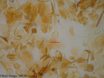 Karl.Henga/Coula_edulis_46835/Coula_edulis_46835_0001(copy)_thumb.jpg
