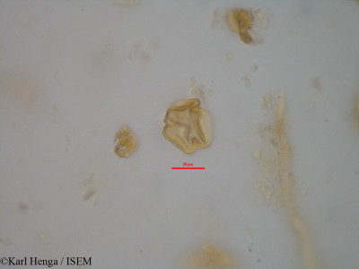 Karl.Henga/Cylicodiscus_gabunensis_7087/Cylicodiscus_gabunensis_7087_0001(copy)_thumb.jpg