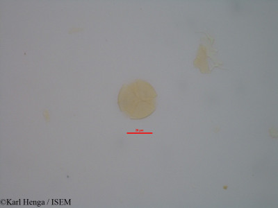 Karl.Henga/Cynometra_schlechteri_11962/Cynometra_schlechteri_11962_0001(copy)_thumb.jpg