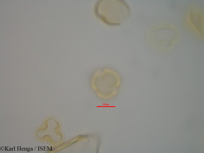 Karl.Henga/Detarium_macrocarpum_42359/Detarium_macrocarpum_42359_0001(copy)_thumb.jpg