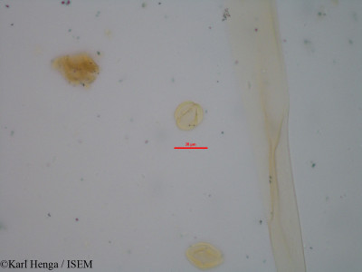 Karl.Henga/Dialium_aubrevillei_19429/Dialium_aubrevillei_19429_0001(copy)_thumb.jpg