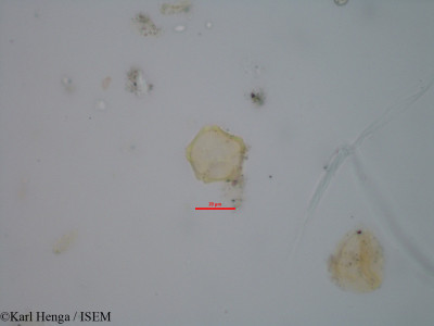 Karl.Henga/Dichapetalum_brevitubulosum_22579/Dichapetalum_brevitubulosum_22579_0001(copy)_thumb.jpg