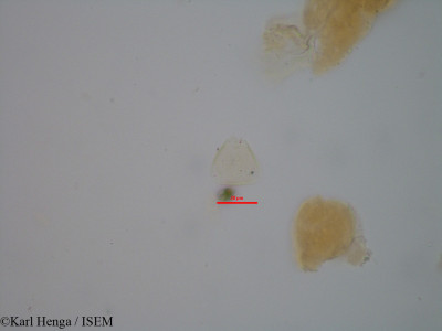 Karl.Henga/Dichapetalum_crassifolium_22580/Dichapetalum_crassifolium_22580_0001(copy)_thumb.jpg
