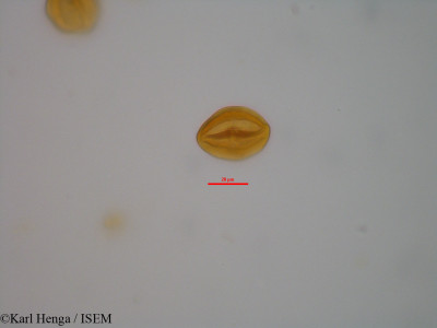 Karl.Henga/Diospyros_gilletii_19600/Diospyros_gilletii_19600_0001(copy)_thumb.jpg