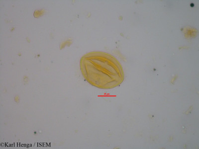 Karl.Henga/Diospyros_mespiliformis_21231/Diospyros_mespiliformis_21231_0001(copy)_thumb.jpg
