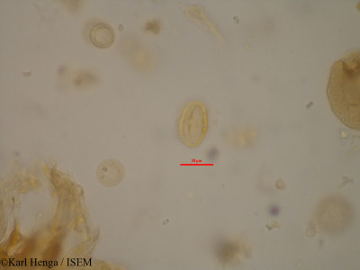 Karl.Henga/Duboscia_macrocarpa_1858/Duboscia_macrocarpa_1858_0001(copy)_thumb.jpg