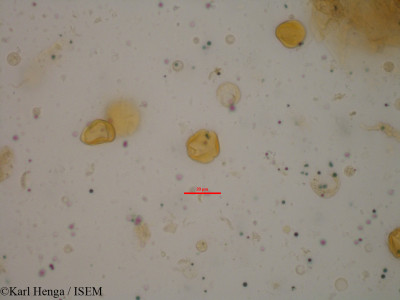 Karl.Henga/Eriocoelum_macrocarpum_7128/Eriocoelum_macrocarpum_7128_0001(copy)_thumb.jpg