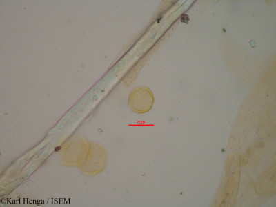 Karl.Henga/Eriocoelum_paniculatum_876/Eriocoelum_paniculatum_876_0001(copy)_thumb.jpg
