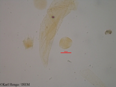 Karl.Henga/Eriocoelum_racemosum_874/Eriocoelum_racemosum_874_0001(copy)_thumb.jpg