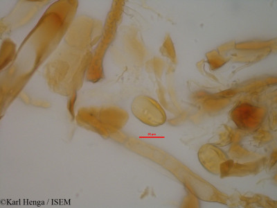 Karl.Henga/Gambeya_boiviniana_33939/Gambeya_boiviniana_33939_0001(copy)_thumb.jpg