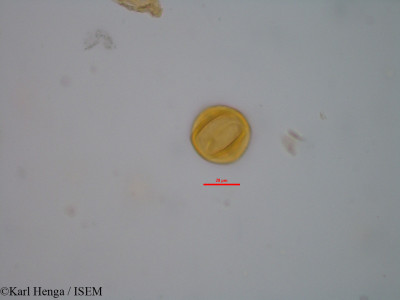 Karl.Henga/Garcinia_ovalifolia_10477/Garcinia_ovalifolia_10477_0001(copy)_thumb.jpg