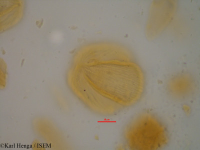 Karl.Henga/Gilbertiodendron_grandistipulatum_35169/Gilbertiodendron_grandistipulatum_35169_0001(copy)_thumb.jpg