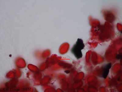 Karl.Henga/Grewia_pinnatifida_28172/Grewia_pinnatifida_28172_0001(copy)_thumb.jpg