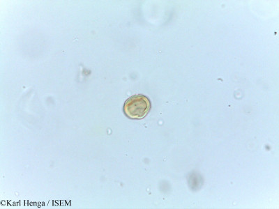 Karl.Henga/Irvingia_malavana_15001/Irvingia_malavana_15001_0001(copy)_thumb.jpg