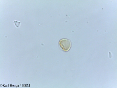 Karl.Henga/Irvingia_wombolu_26569/Irvingia_wombolu_26569_0001(copy)_thumb.jpg
