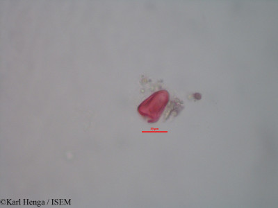 Karl.Henga/Kyllinga_polyphylla_28180/Kyllinga_polyphylla_28180_0001(copy)_thumb.jpg